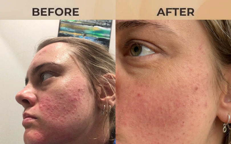 +14'000 people trusted us and got results