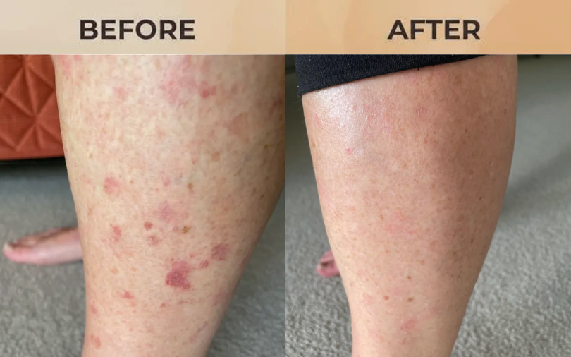 +14'000 people trusted us and got results